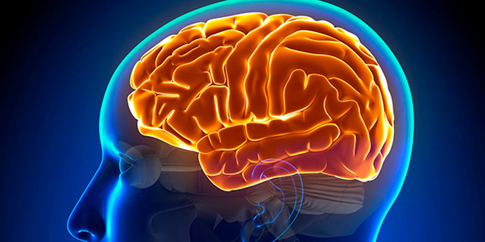 hidrocefalia normobarica.jpg